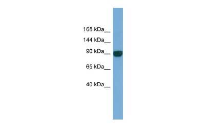 Western Blot: UNC45A Antibody [NBP2-88556] - WB Suggested Anti-UNC45A Antibody Titration: 0.2-1 ug/ml. ELISA Titer: 1:62500. Positive Control: Human Lung