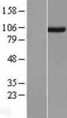 Western Blot: UNC45A Overexpression Lysate (Adult Normal) [NBL1-17612] Left-Empty vector transfected control cell lysate (HEK293 cell lysate); Right -Over-expression Lysate for UNC45A.