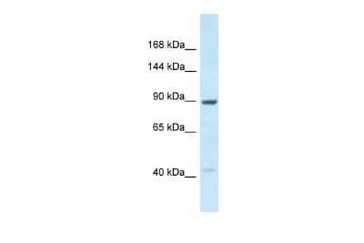 Western Blot: UNC45B Antibody [NBP2-88557] - Host: Rabbit. Target Name: UNC45B. Sample Type: 721_B whole cell lysates. Antibody Dilution: 1.0ug/ml
