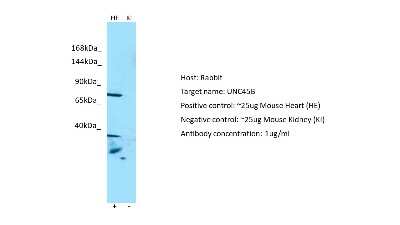 Western Blot: UNC45B Antibody [NBP2-88557] - Host: Rabbit. Target: UNC45B. Positive control (+): Mouse Heart (M-HE). Negative control (-): Mouse Kidney (M-KI). Antibody concentration: 1ug/ml
