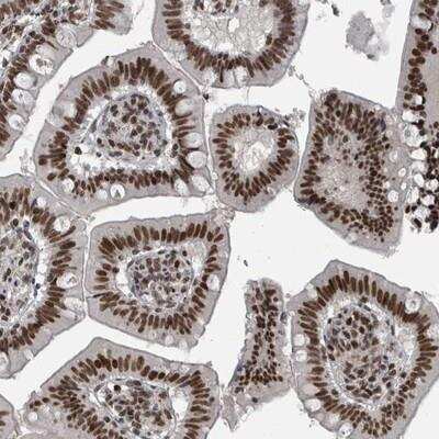 Immunohistochemistry-Paraffin: UNC50 Antibody [NBP1-81816] - Staining of human small intestine shows strong nuclear positivity in glandular cells.