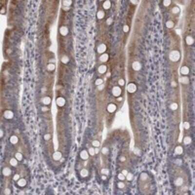 Immunohistochemistry-Paraffin: UNC5H2/UNC5B Antibody [NBP3-17778] - Staining of human small intestine shows strong cytoplasmic positivity in glandular cells.