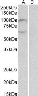 Western Blot: UNC5H2/UNC5B Antibody [NBP2-42523] - Analysis of Human Bone Marrow lysate (35 ug protein in RIPA buffer) with (B) and without (A) blocking with the immunizing peptide. Primary incubation was 1 hour. Detected by chemiluminescence.
