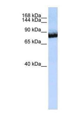 Western Blot: UNC5H3/UNC5C Antibody [NBP1-69283] - This Anti-UNC5C antibody was used in Western Blot of Jurkat tissue lysate at a concentration of 1ug/ml.