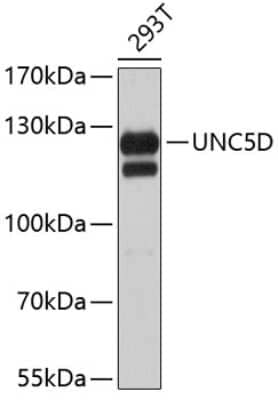Western Blot: UNC5H4/UNC5D Antibody [NBP3-03205] - Analysis of extracts of 293T cells, using UNC5H4/UNC5D antibody . Secondary antibody: HRP Goat Anti-Rabbit IgG (H+L) at 1:10000 dilution. Lysates/proteins: 25ug per lane. Blocking buffer: 3% nonfat dry milk in TBST.