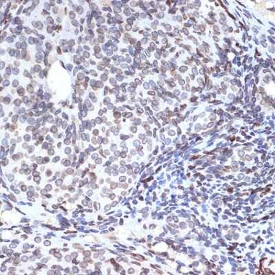 Immunohistochemistry-Paraffin UNC84B Antibody (8E8D7)