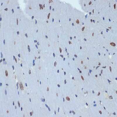 Immunohistochemistry-Paraffin: UNC84B Antibody (8E8D7) [NBP3-15912] - Immunohistochemistry of paraffin-embedded mouse heart using UNC84B Rabbit mAb (NBP3-15912) at dilution of 1:100 (40x lens).Perform microwave antigen retrieval with 10 mM Tris/EDTA buffer pH 9.0 before commencing with IHC staining protocol.