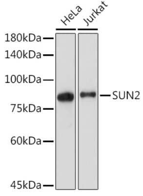 Western Blot UNC84B Antibody (8E8D7)