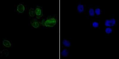 Immunocytochemistry/Immunofluorescence: UNC84B Antibody (JG39-52) [NBP2-75696] - Staining SUN2 (green) in SK-Br-3 cells. The nuclear counter stain is DAPI (blue). Cells were fixed in paraformaldehyde, permeabilised with 0.25% Triton X100/PBS.