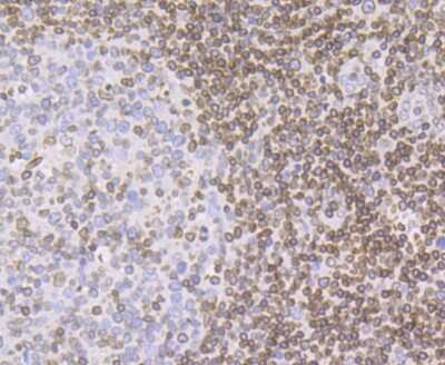 Immunohistochemistry-Paraffin: UNC84B Antibody (JG39-52) [NBP2-75696] - Analysis of paraffin-embedded human tonsil tissue using anti-SUN2 antibody. Counter stained with hematoxylin.