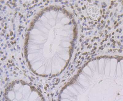 Immunohistochemistry-Paraffin: UNC84B Antibody (JG39-52) [NBP2-75696] - Analysis of paraffin-embedded human colon tissue using anti-SUN2 antibody. Counter stained with hematoxylin.