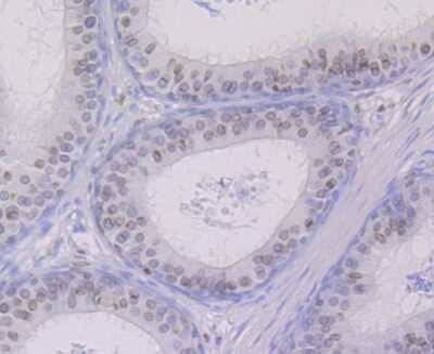 Immunohistochemistry-Paraffin: UNC84B Antibody (JG39-52) [NBP2-75696] - Analysis of paraffin-embedded rat epididymis tissue using anti-SUN2 antibody. Counter stained with hematoxylin.
