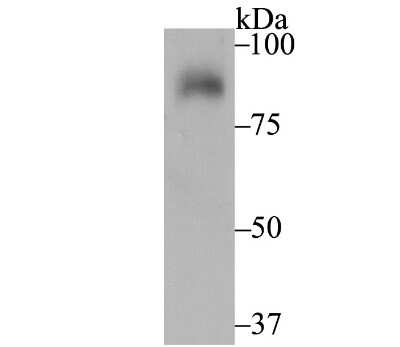 Western Blot: UNC84B Antibody (JG39-52) [NBP2-75696] - Analysis of SUN2 on rat kidney tissue lysate using anti-SUN2 antibody at 1/2,000 dilution.