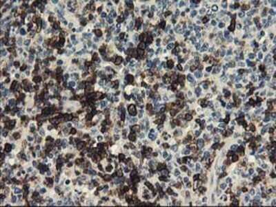 Immunohistochemistry: UNG Antibody (OTI1A11) - Azide and BSA Free [NBP2-74785] - Staining of paraffin-embedded Human lymphoma tissue using anti-uracil-DNA glycosylase mouse monoclonal antibody.