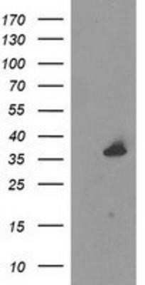 Western Blot: UNG Antibody (OTI1A11) - Azide and BSA Free [NBP2-74785] - HEK293T cells were transfected with the pCMV6-ENTRY control (Left lane) or pCMV6-ENTRY uracil-DNA glycosylase (Right lane) cDNA for 48 hrs and lysed. Equivalent amounts of cell lysates (5 ug per lane) were separated by SDS-PAGE and immunoblotted with anti