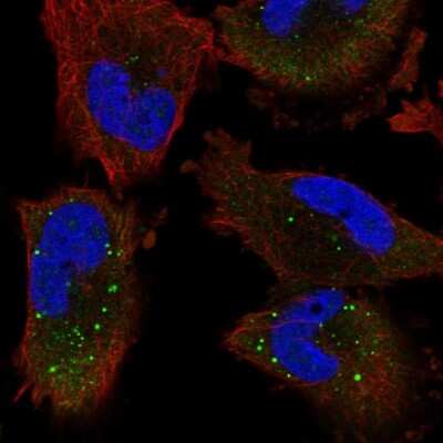 Immunocytochemistry/Immunofluorescence: UNK Antibody [NBP1-89595] - Staining of human cell line U-251 MG shows localization to cytosol & cytoplasmic bodies.