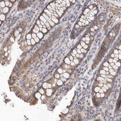 Immunohistochemistry-Paraffin: UNK Antibody [NBP1-89596] - Staining of human colon shows cytoplasmic positivity in glandular cells.