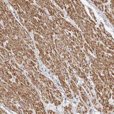 Immunohistochemistry-Paraffin: UNK Antibody [NBP1-89595] - Staining of human smooth muscle shows distinct cytoplasmic positivity in smooth muscle cells.