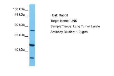 Western Blot: UNK Antibody [NBP2-86041] - Host: Rabbit. Target Name: UNK. Sample Type: Lung Tumor. Antibody Dilution: 1.0ug/ml