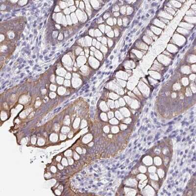 Immunohistochemistry-Paraffin: UNKL Antibody [NBP2-33766] - Staining of human colon shows moderate membranous and cytoplasmic positivity in glandular cells.