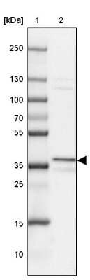 Western Blot: UNKL Antibody [NBP2-33766] - Lane 1: Marker  [kDa] 250, 130, 100, 70, 55, 35, 25, 15, 10.  Lane 2: A-549