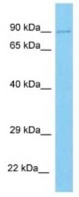 Western Blot: UNKL Antibody [NBP3-10277] - Western blot analysis of UNKL in Human DLD1 Whole Cell lysates. Antibody dilution at 1ug/ml