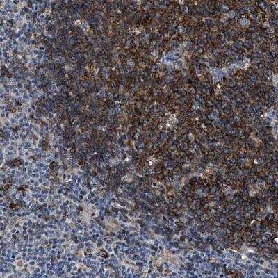 Immunohistochemistry-Paraffin: UNQ6411 Antibody [NBP1-90648] - Staining of human lymph node shows strong cytoplasmic positivity in reaction center cells.