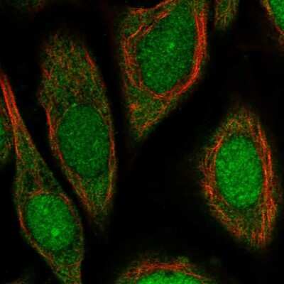 <b>Independent Antibodies Validation. </b>Immunocytochemistry/Immunofluorescence: UPF3B Antibody [NBP2-55617] - Staining of human cell line SiHa shows localization to nucleus, nucleoli & cytosol.