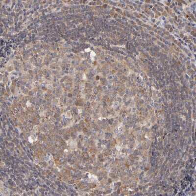 Immunohistochemistry-Paraffin: UPF3B Antibody [NBP1-83134] - Staining of human lymphoid tissues shows moderate cytoplasmic positivity in germinal center cells.