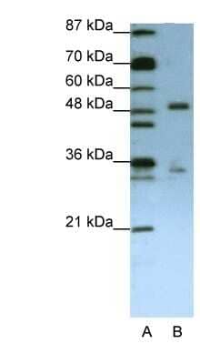 Western Blot: UPF3B Antibody [NBP1-57232] - Jurkat cell lysate, Antibody Titration: 1.25ug/ml