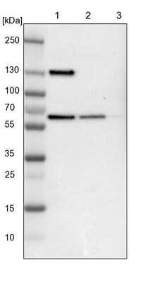 Western Blot: UPF3B Antibody [NBP1-83135] - Lane 1: NIH-3T3 cell lysate (Mouse embryonic fibroblast cells). Lane 2: NBT-II cell lysate (Rat Wistar bladder tumor cells). Lane 3: PC12 cell lysate (Pheochromocytoma of rat adrenal medulla).