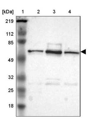 Western Blot: UPF3B Antibody [NBP1-83135] - Lane 1: Marker  [kDa] 219, 112, 85, 49, 32, 25, 18.   Lane 2: Human cell line RT-4.  Lane 3: Human cell line U-251MG sp.  Lane 4: Human cell line A-431