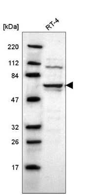 Western Blot: UPF3B Antibody [NBP2-55617] - Western blot analysis in human cell line RT-4.