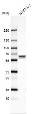 Western Blot: UPF3B Antibody [NBP2-55617] - Analysis in human cell line NTERA-2.