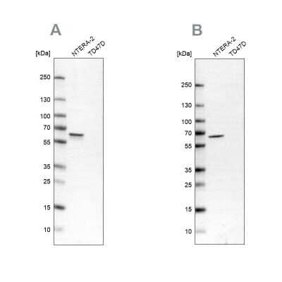 Western Blot: UPF3B Antibody [NBP2-55617] - Analysis using Anti-UPF3B antibody NBP2-55617 (A) shows similar pattern to independent antibody NBP1-83134 (B).