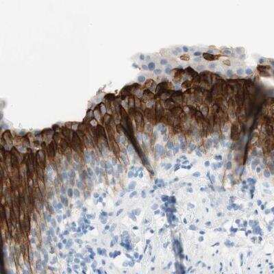 Immunohistochemistry-Paraffin: UPK3BL Antibody [NBP2-46656] - Staining of human urinary bladder shows strong cytoplasmic and membranous positivity in urothelial cells.