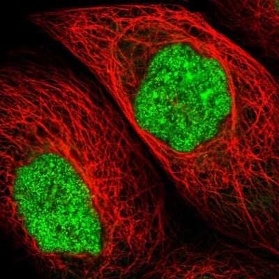 Immunocytochemistry/Immunofluorescence: UPP2 Antibody [NBP1-80647] - Immunofluorescent staining of human cell line A-431 shows positivity in nucleus but not nucleoli. Antibody staining is shown in green.