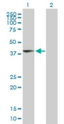 Western Blot: UPP2 Antibody [H00151531-B01P] - Analysis of UPP2 expression in transfected 293T cell line by UPP2 polyclonal antibody.  Lane 1: UPP2 transfected lysate(34.87 KDa). Lane 2: Non-transfected lysate.