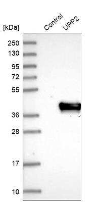 Western Blot: UPP2 Antibody [NBP1-80646] - Analysis in control (vector only transfected HEK293T lysate) and UPP2 over-expression lysate (Co-expressed with a C-terminal myc-DDK tag (~3.1 kDa) in mammalian HEK293T cells).