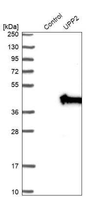 Western Blot: UPP2 Antibody [NBP1-80647] - Analysis in control (vector only transfected HEK293T lysate) and UPP2 over-expression lysate (Co-expressed with a C-terminal myc-DDK tag (~3.1 kDa) in mammalian HEK293T cells).