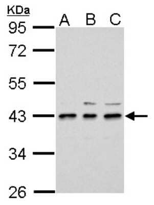 Western Blot: UPP2 Antibody [NBP2-20814] - Sample (30 ug of whole cell lysate) A: 293T B: A431 C: HeLa 10% SDS PAGE gel, diluted at 1:3000.