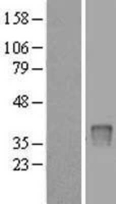 Western Blot: UPP2 Overexpression Lysate (Adult Normal) [NBL1-17626] Left-Empty vector transfected control cell lysate (HEK293 cell lysate); Right -Over-expression Lysate for UPP2.