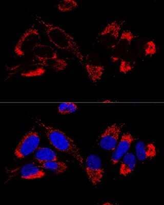 Immunocytochemistry/ Immunofluorescence UQCR10 Antibody - BSA Free