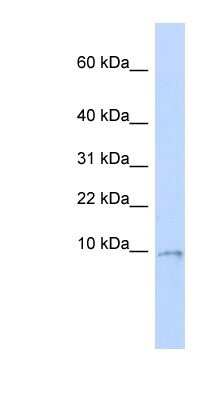 Western Blot: UQCR10 Antibody [NBP1-62349] - MCF-7 whole cell lysates, concentration 0.2-1 ug/ml.