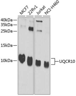 Western Blot: UQCR10 Antibody [NBP2-93220] - Analysis of extracts of various cell lines, using UQCR10 . Exposure time: 30s.