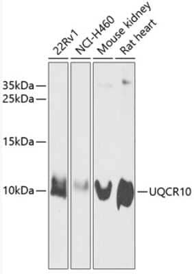 Western Blot UQCR10 Antibody - BSA Free