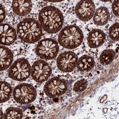 Immunohistochemistry-Paraffin UQCRB Antibody