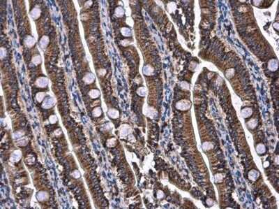 Immunohistochemistry-Paraffin: UQCRB Antibody [NBP3-12970] - UQCRB antibody detects UQCRB protein at mitochondria in rat intestine by immunohistochemical analysis. Sample: Paraffin-embedded rat intestine. UQCRB antibody (NBP3-12970) diluted at 1:500. Antigen Retrieval: Citrate buffer, pH 6.0, 15 min