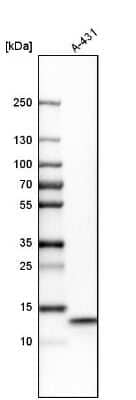 Western Blot UQCRB Antibody