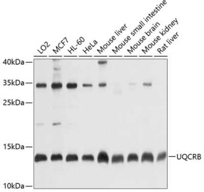 Western Blot: UQCRB Antibody [NBP2-93224] - Analysis of extracts of various cell lines, using UQCRB at 1:1000 dilution. Secondary antibody: HRP Goat Anti-Rabbit IgG (H+L) at 1:10000 dilution. Lysates/proteins: 25ug per lane. Blocking buffer: 3% nonfat dry milk in TBST. Detection: ECL Basic Kit . Exposure time: 10s.